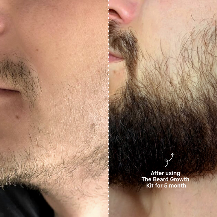 MANITY Beard Growth Kit